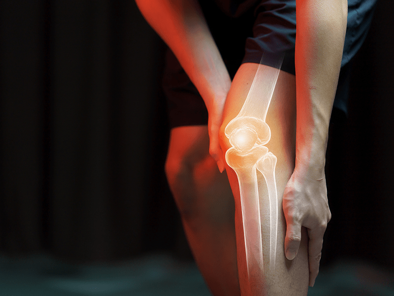 Types, Risk and Recovery Information About Bilateral Knee Replacement